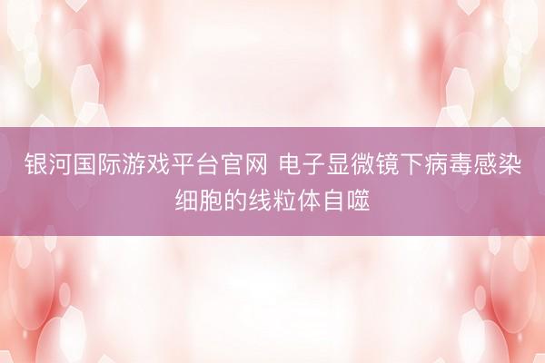 银河国际游戏平台官网 电子显微镜下病毒感染细胞的线粒体自噬